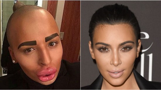 英男粉絲斥巨資百萬整容成男版金&bull;卡戴珊